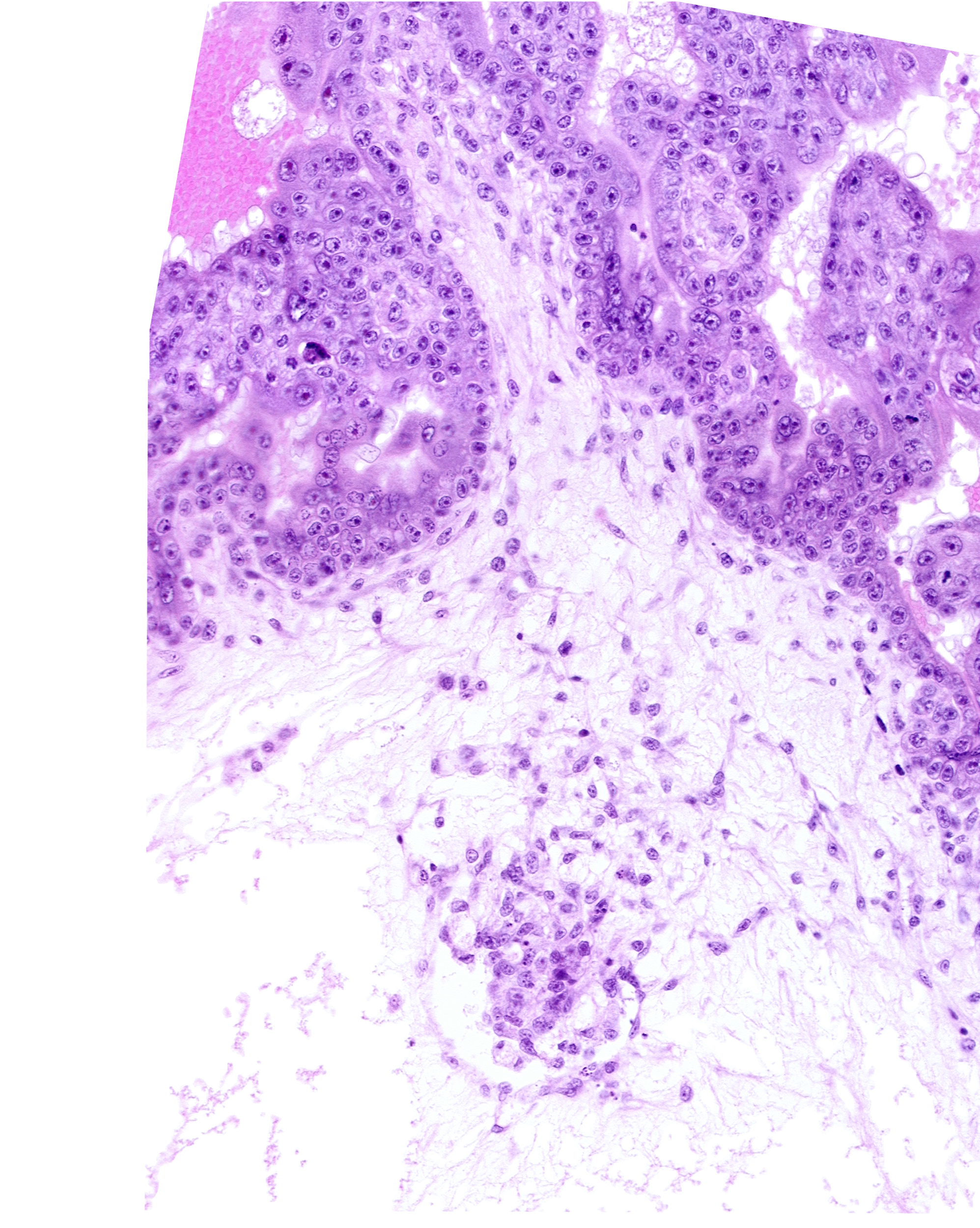 caudal part of endodermal mass, extra-embryonic coelom, extra-embryonic mesoblast, hemangioblastic tissue, mesoblast (mesenchyme) core of secondary stem villus, primordial germ cell(s)
