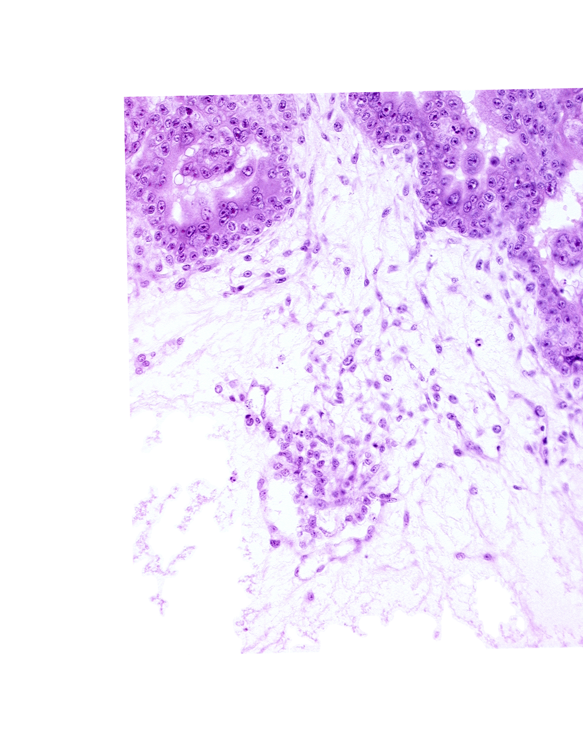 extra-embryonic coelom, syncytiotrophoblast