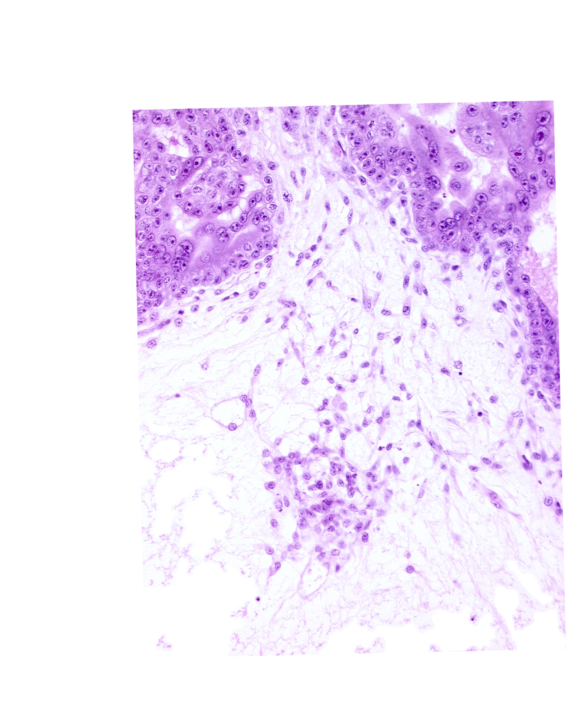 cytotrophoblast, extra-embryonic coelom, primordial germ cell(s)