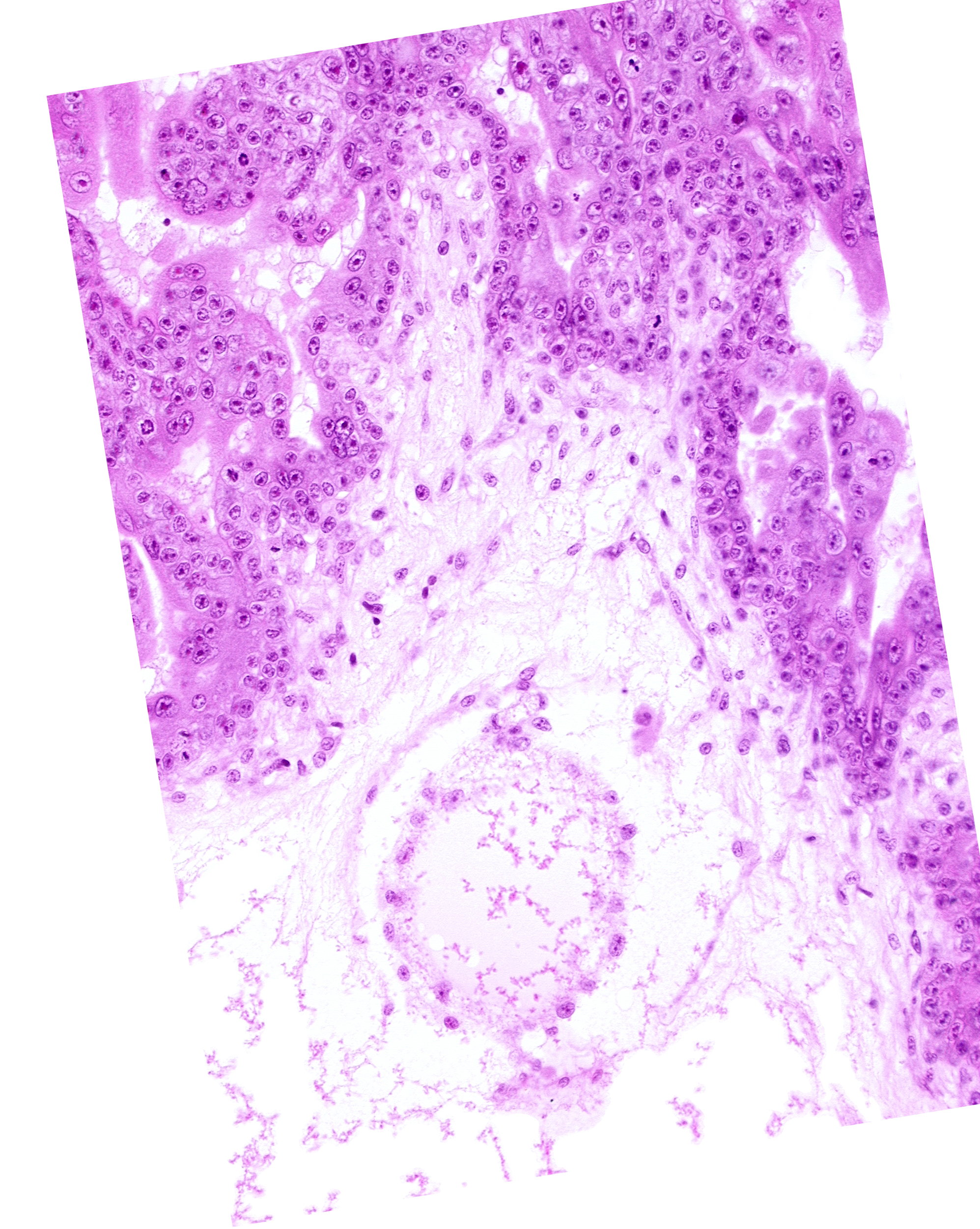 cephalic part of secondary umbilical vesicle wall, extra-embryonic coelom (exocoelom), intervillus space(s), secondary umbilical vesicle wall, trophoblast
