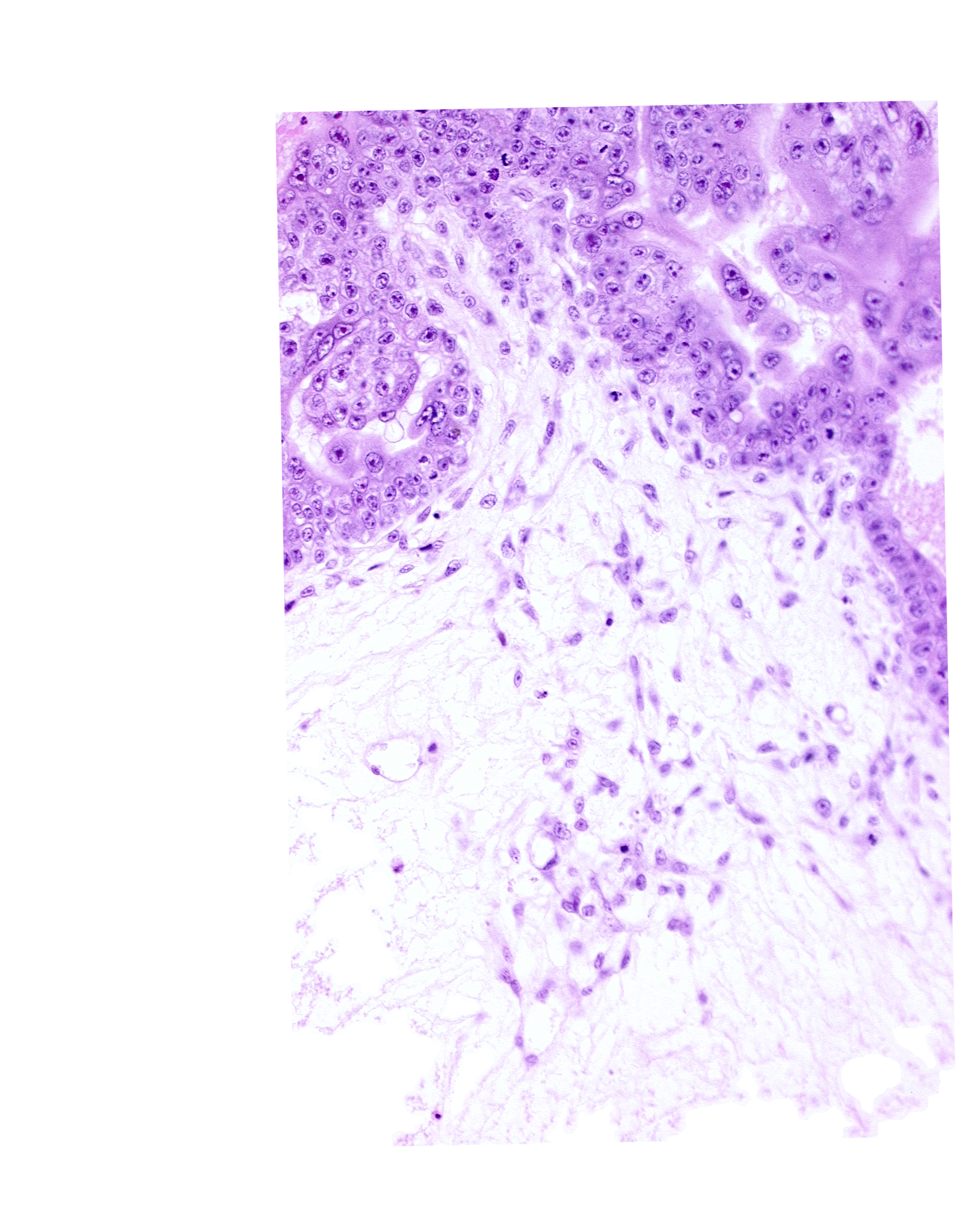cytotrophoblast, extra-embryonic coelom, mesoblast (mesenchyme) core of secondary stem villus, mesoblast(s) in caudal wall of secondary umbilical vesicle, primordial blood vessel(s), primordial connecting stalk, primordial germ cell(s), syncytiotrophoblast