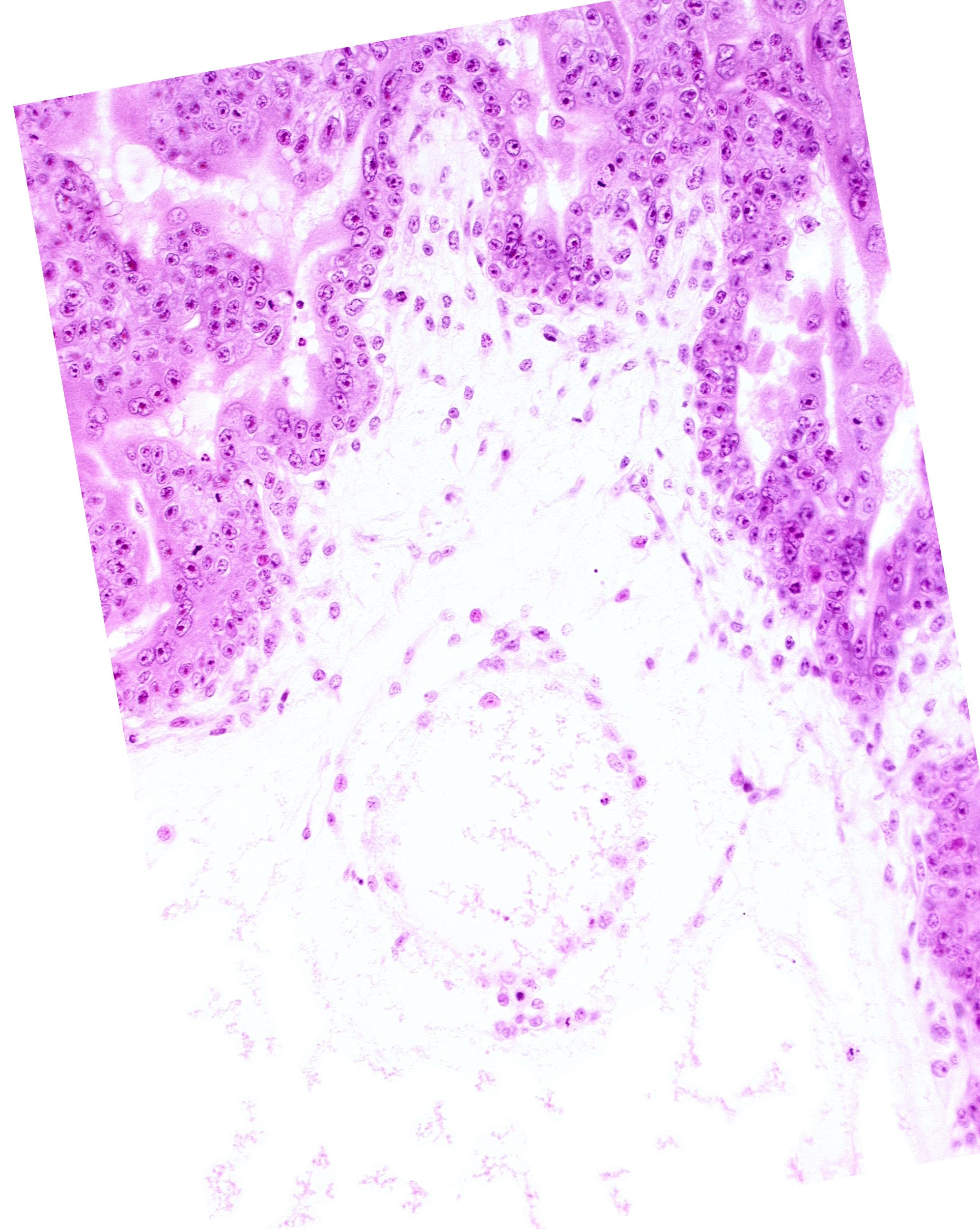 extra-embryonic coelom (exocoelom), trophoblast