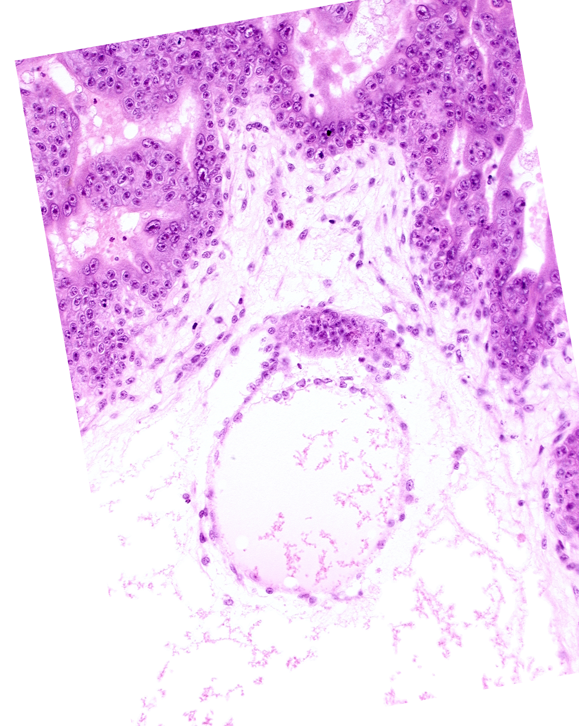 cephalic part of embryonic disc, cytotrophoblast, extra-embryonic coelom, mesoblast (mesenchyme)