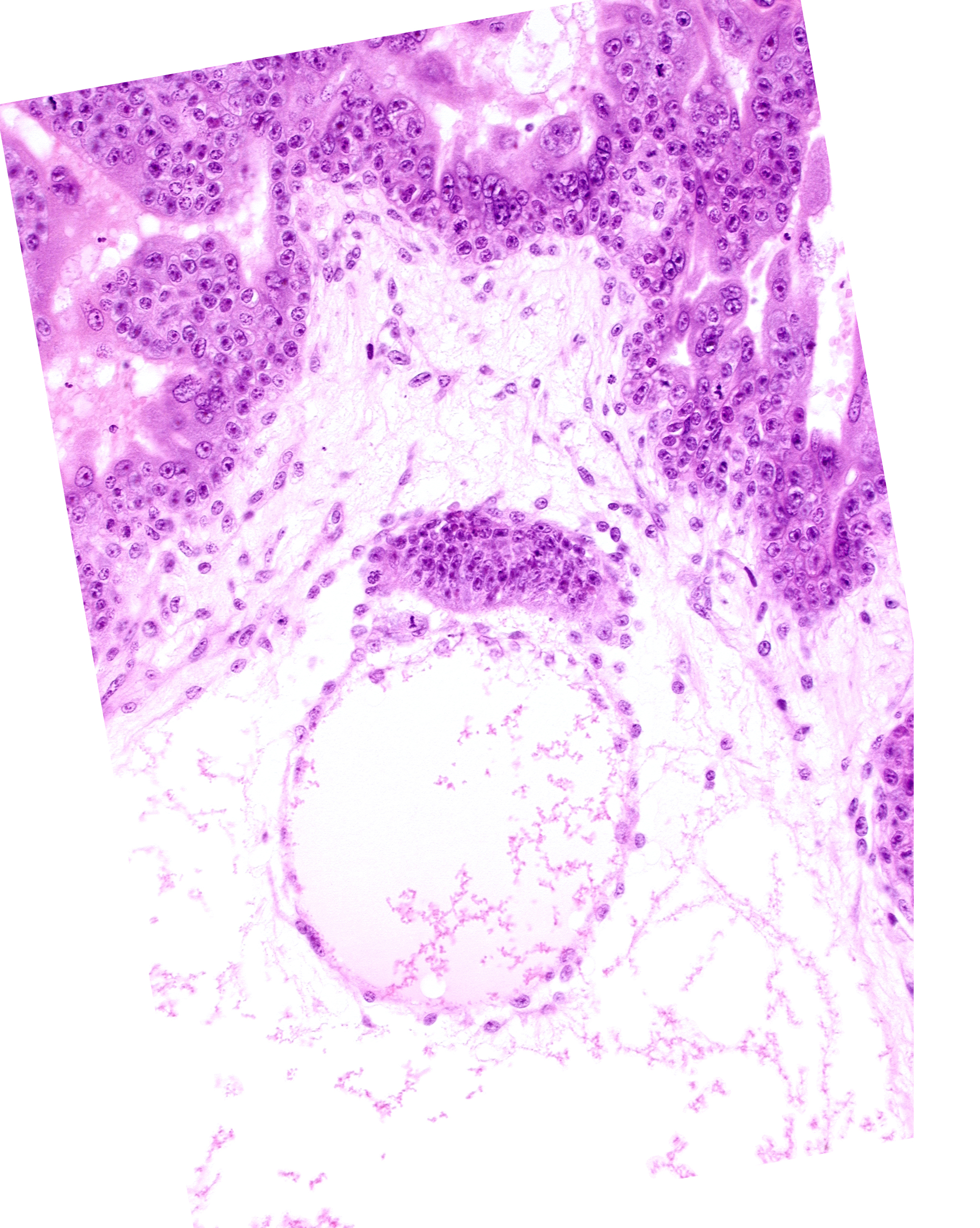 extra-embryonic coelom, intervillus space(s), secondary villus