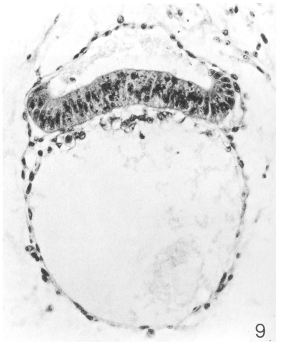 Amniotic cavity, embryonic disc, umbilical vesicle