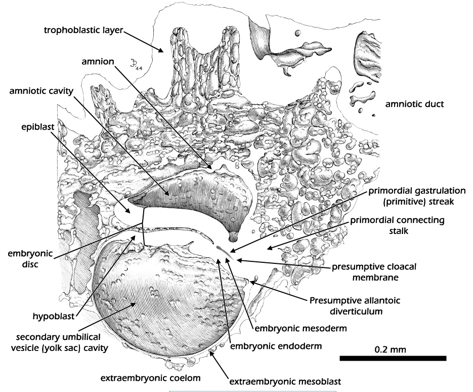 Median sagittal plane - Labeled drawing