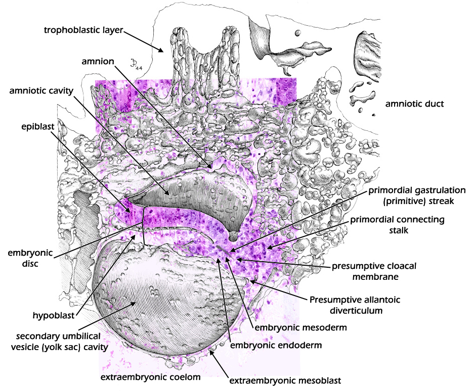 Median sagittal plane - Labeled overlay