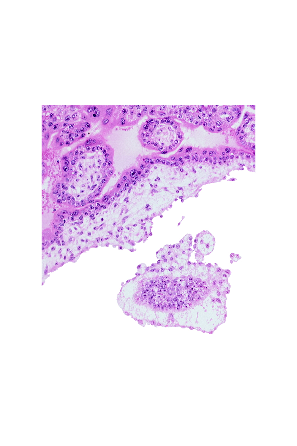 cephalic part of embryonic disc, chorionic cavity