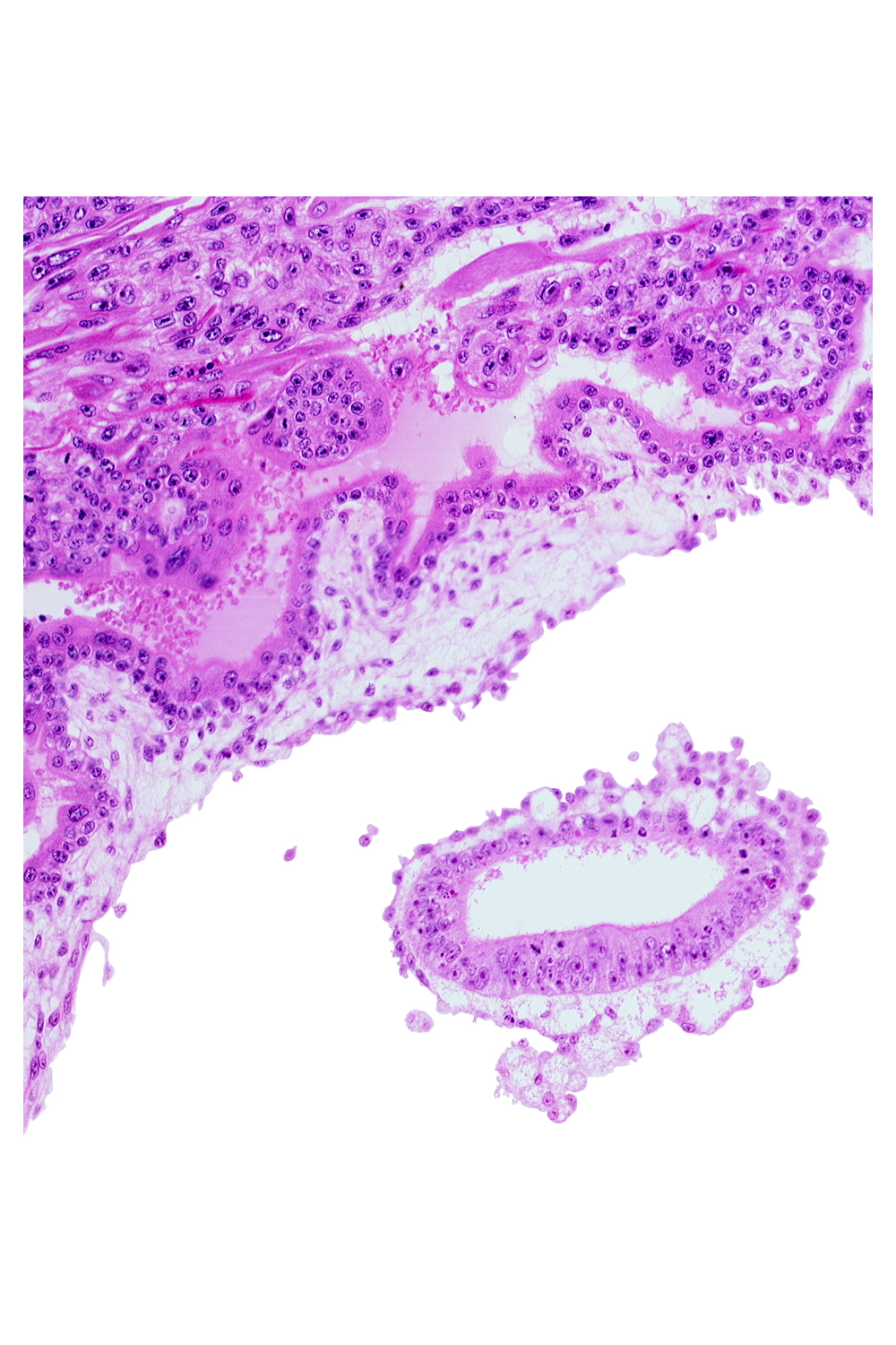 amniotic cavity, chorionic cavity, mesoblast, primordial blood vessel(s)