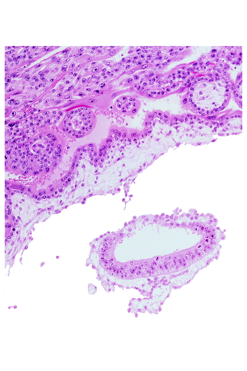 amniotic cavity, cephalic part of amnion, epiblast, mesoblast