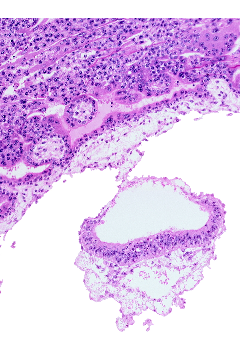 amnion, amniotic cavity, cephalic edge of umbilical vesicle cavity, epiblast, extra-embryonic mesoblast, hypoblast, junction of amnion and embryonic disc