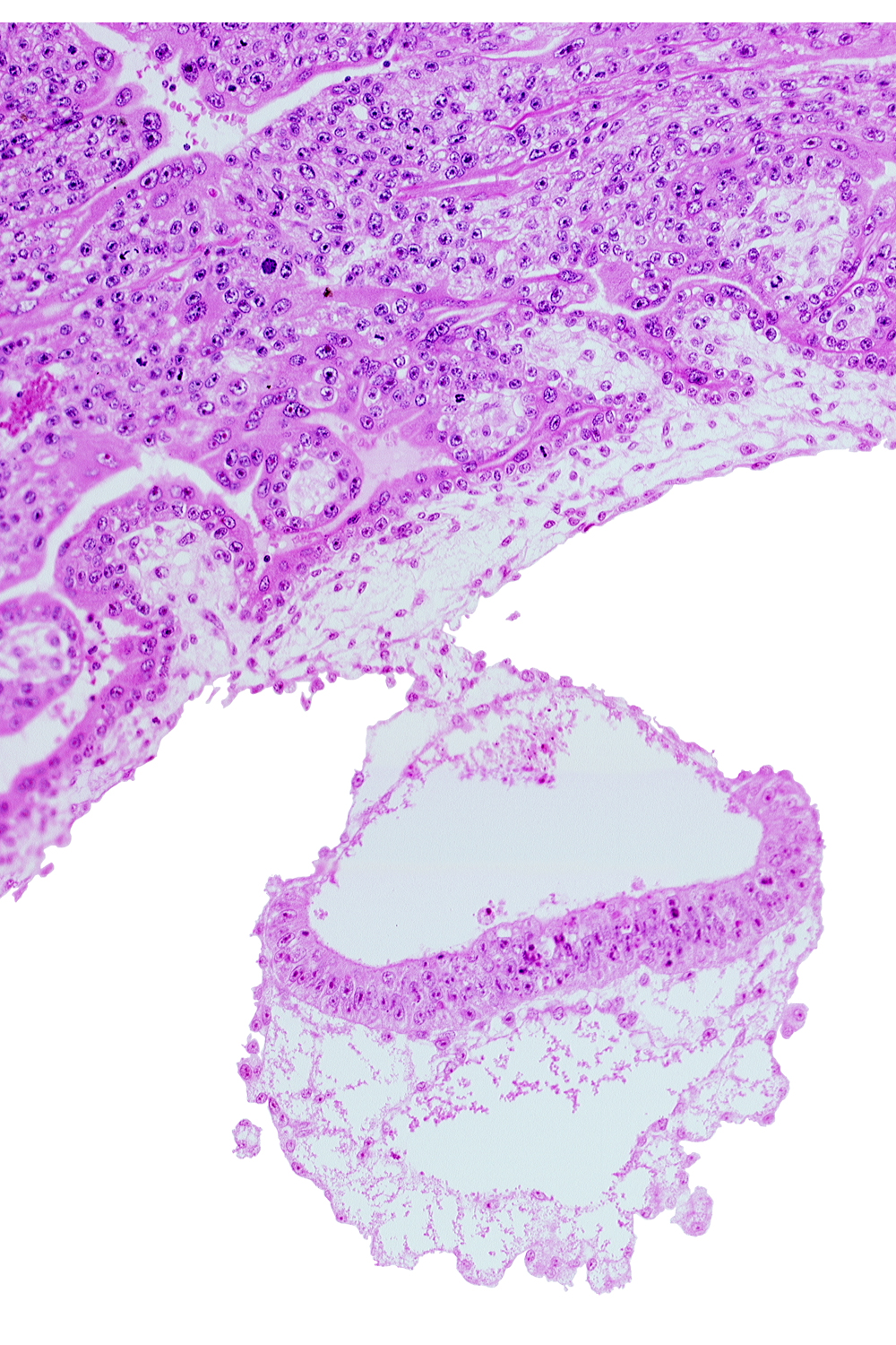 amniotic cavity, connecting stalk, epiblast, extra-embryonic endoderm, head mesenchyme, hypoblast, mesothelium, two-layered umbilical vesicle wall, umbilical vesicle cavity