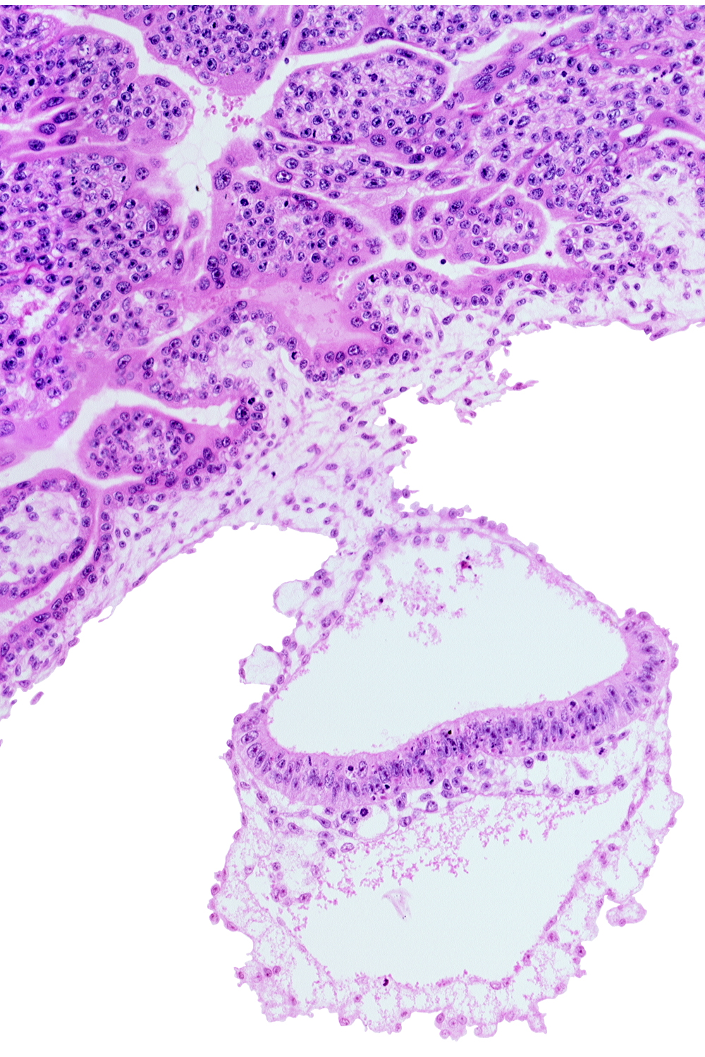 connecting stalk, epiblast, head mesenchyme, hypoblast, notochordal process, presumptive neural plate