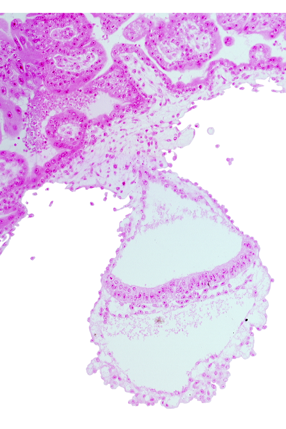 cephalic part of amniotic duct, connecting stalk, embryonic endoderm, embryonic mesoderm, extra-embryonic ectoderm, extra-embryonic endoderm, transition from gastrulation node to gastrulation (primitive) streak, umbilical vesicle cavity