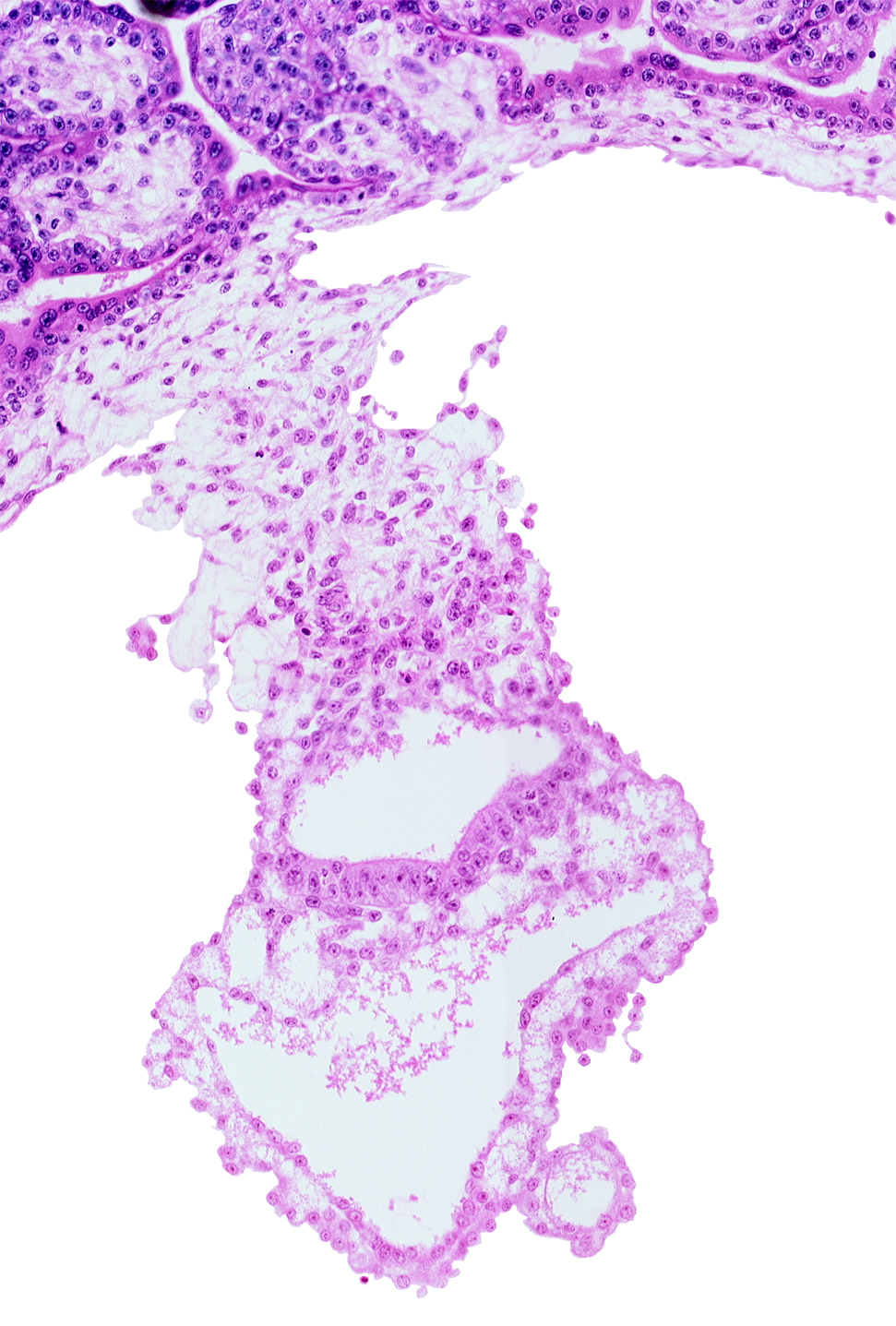 connecting stalk, embryonic endoderm, embryonic mesoderm, epiblast, extra-embryonic endoderm, gastrulation (primitive) groove, gastrulation (primitive) streak