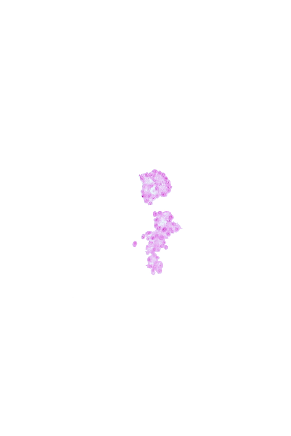 caudal part of umbilical vesicle wall