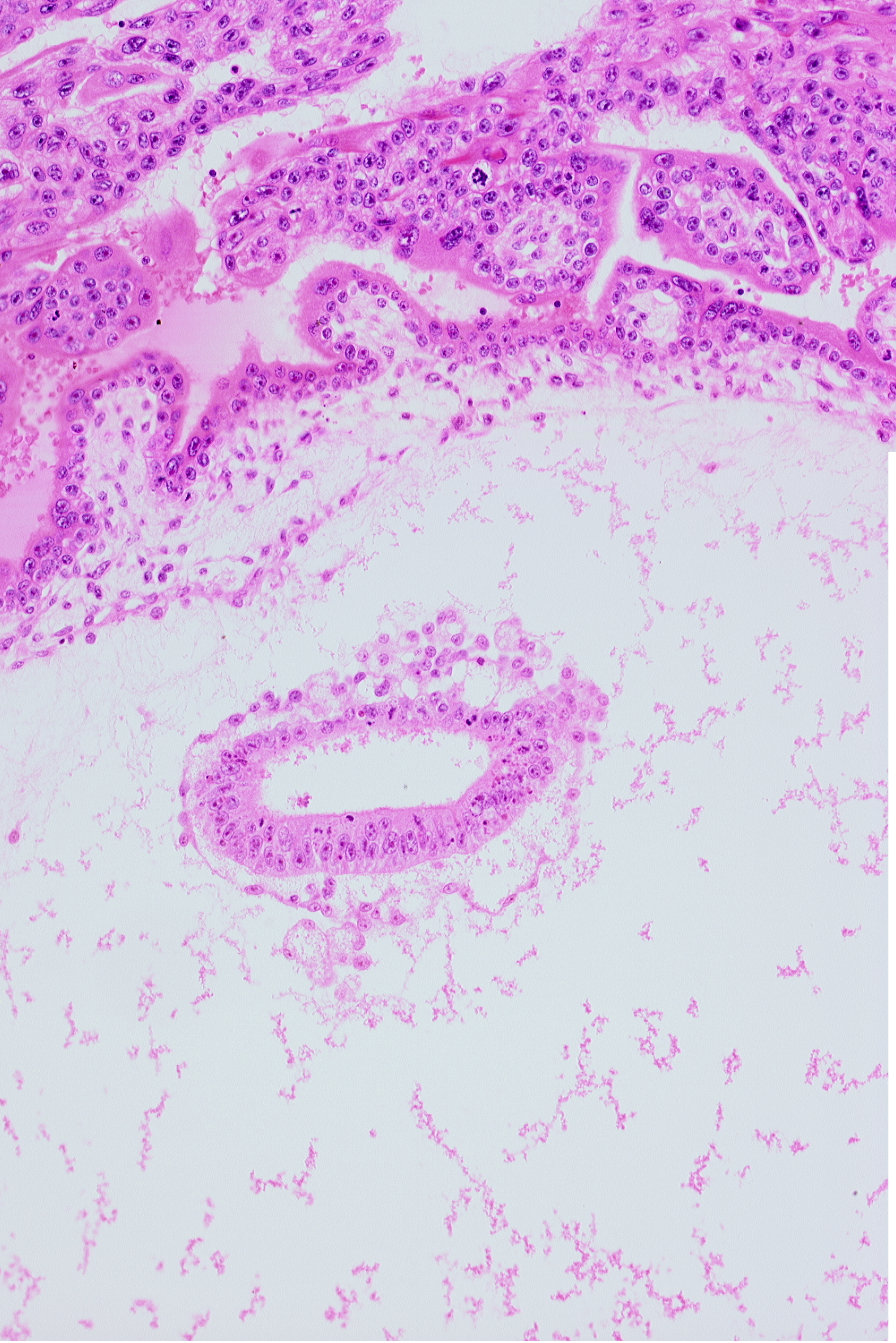 amniotic cavity, chorionic cavity, epiblast, mesoblast, primordial blood vessel(s)