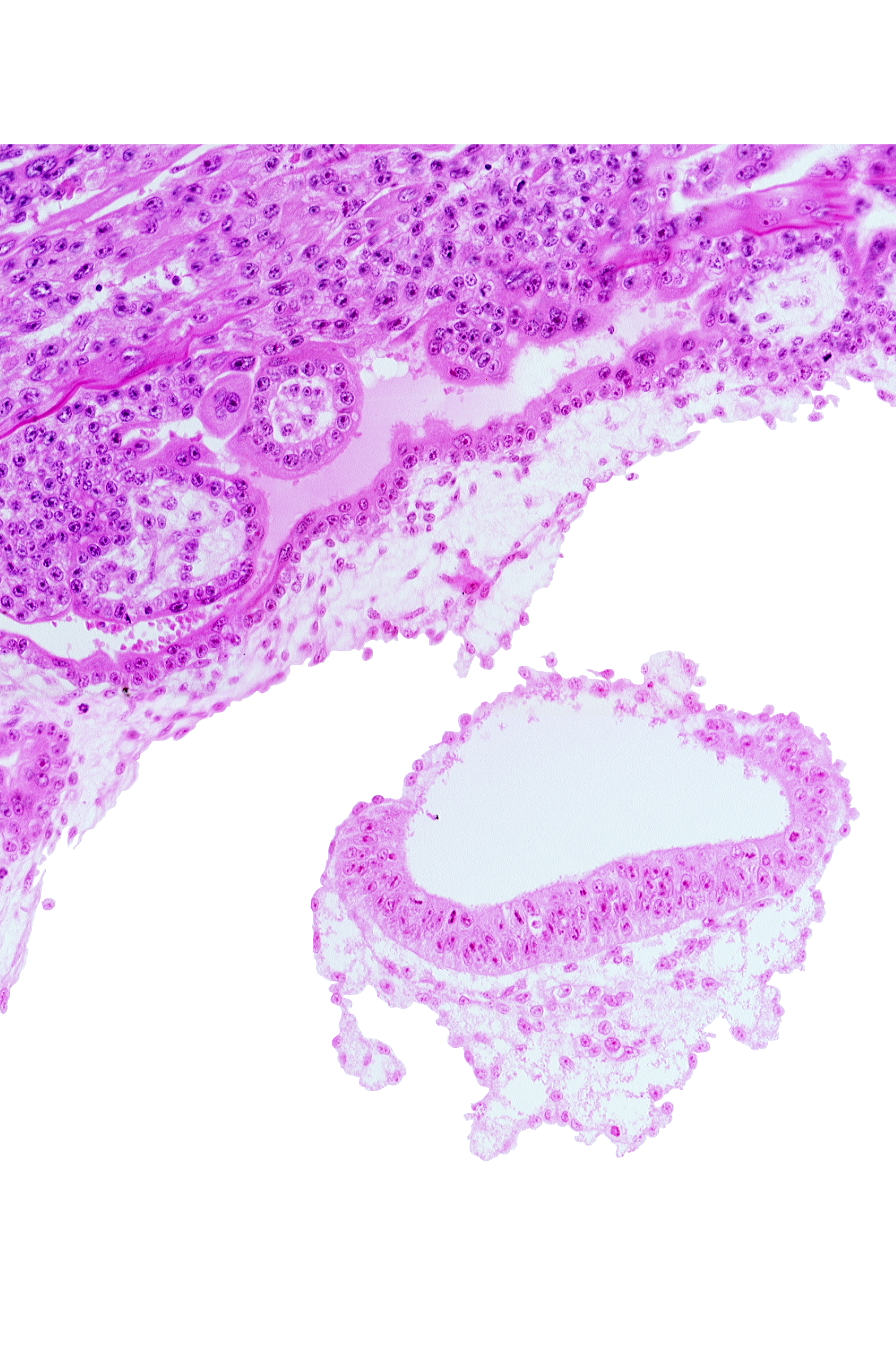 amnion, amniotic cavity, extra-embryonic mesoblast (somatopleuric layer), head mesenchyme
