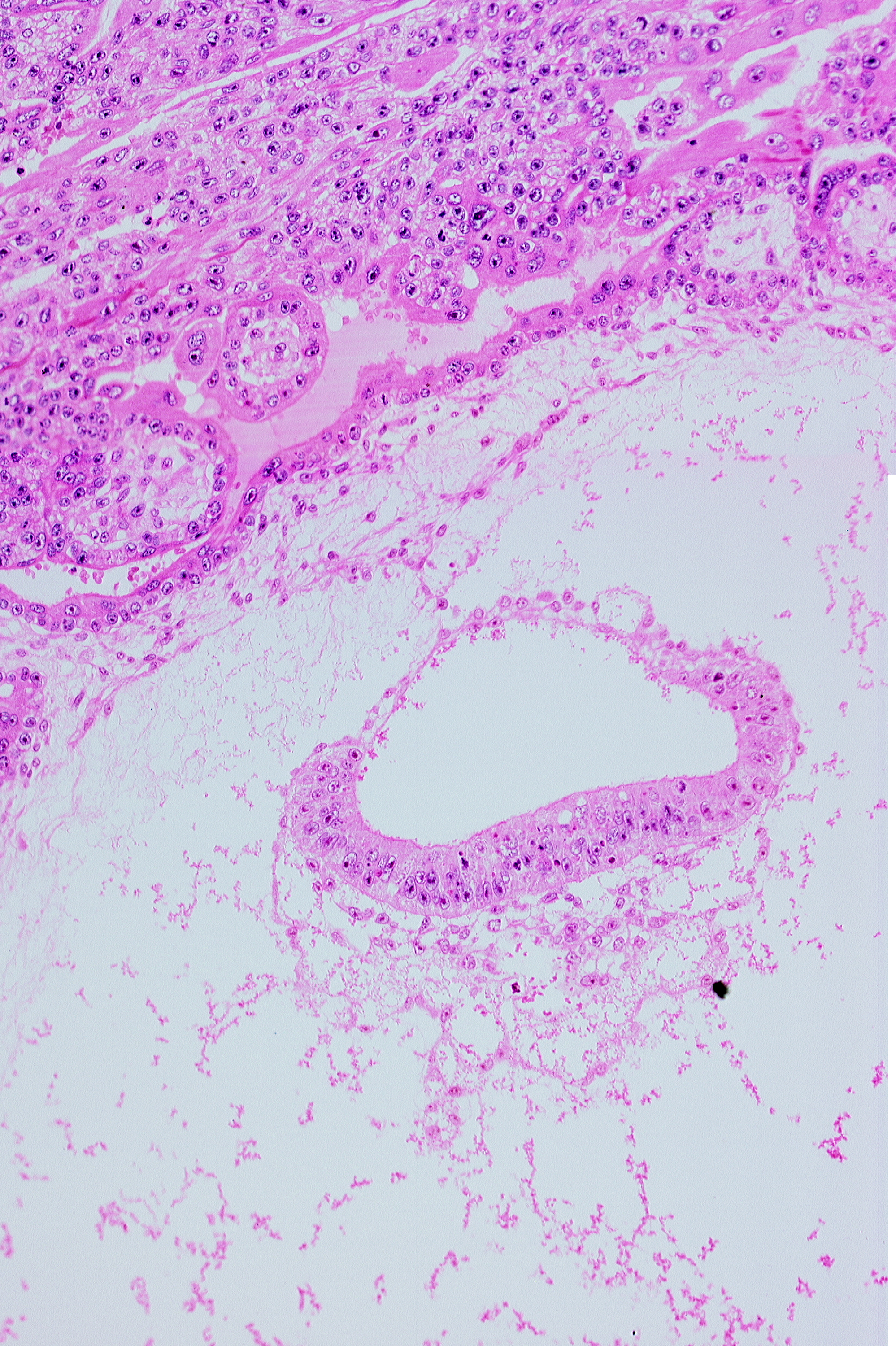 amnion, amniotic cavity, embryonic disc, extra-embryonic mesoblast (somatopleuric layer)