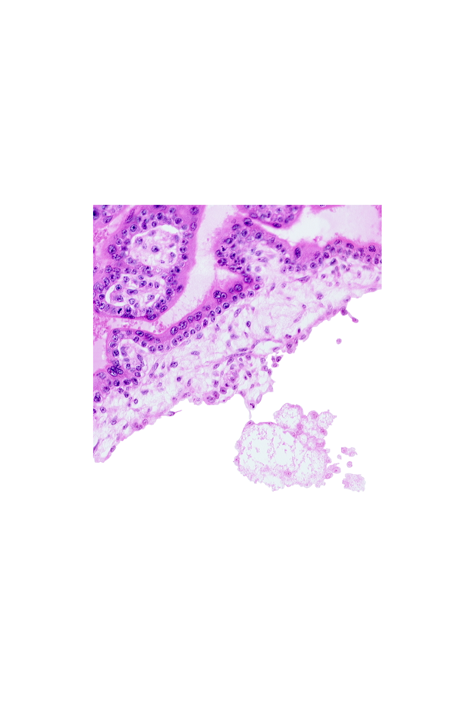 cephalic edge of connecting stalk, chorionic cavity, extra-embryonic mesoblast