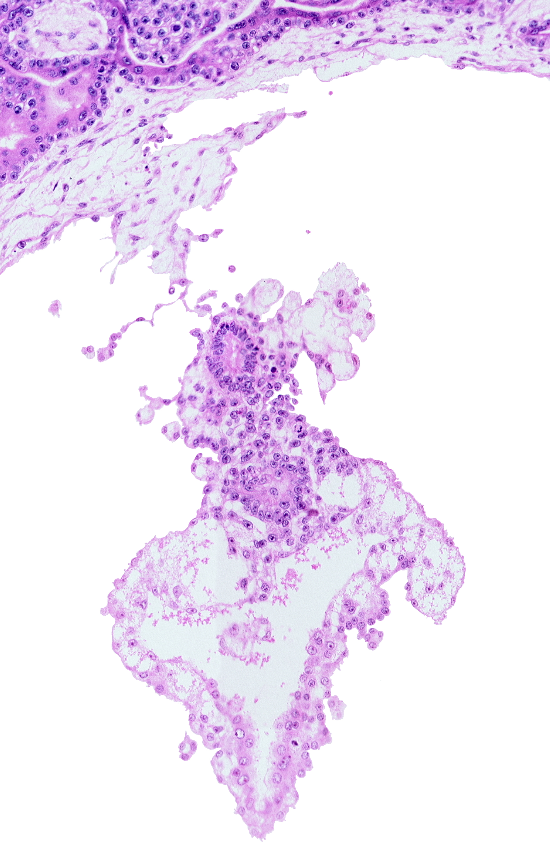 allantoic diverticulum (duct), cephalic edge of amnion, cloacal membrane, embryonic endoderm, internal cyst, umbilical vesicle cavity