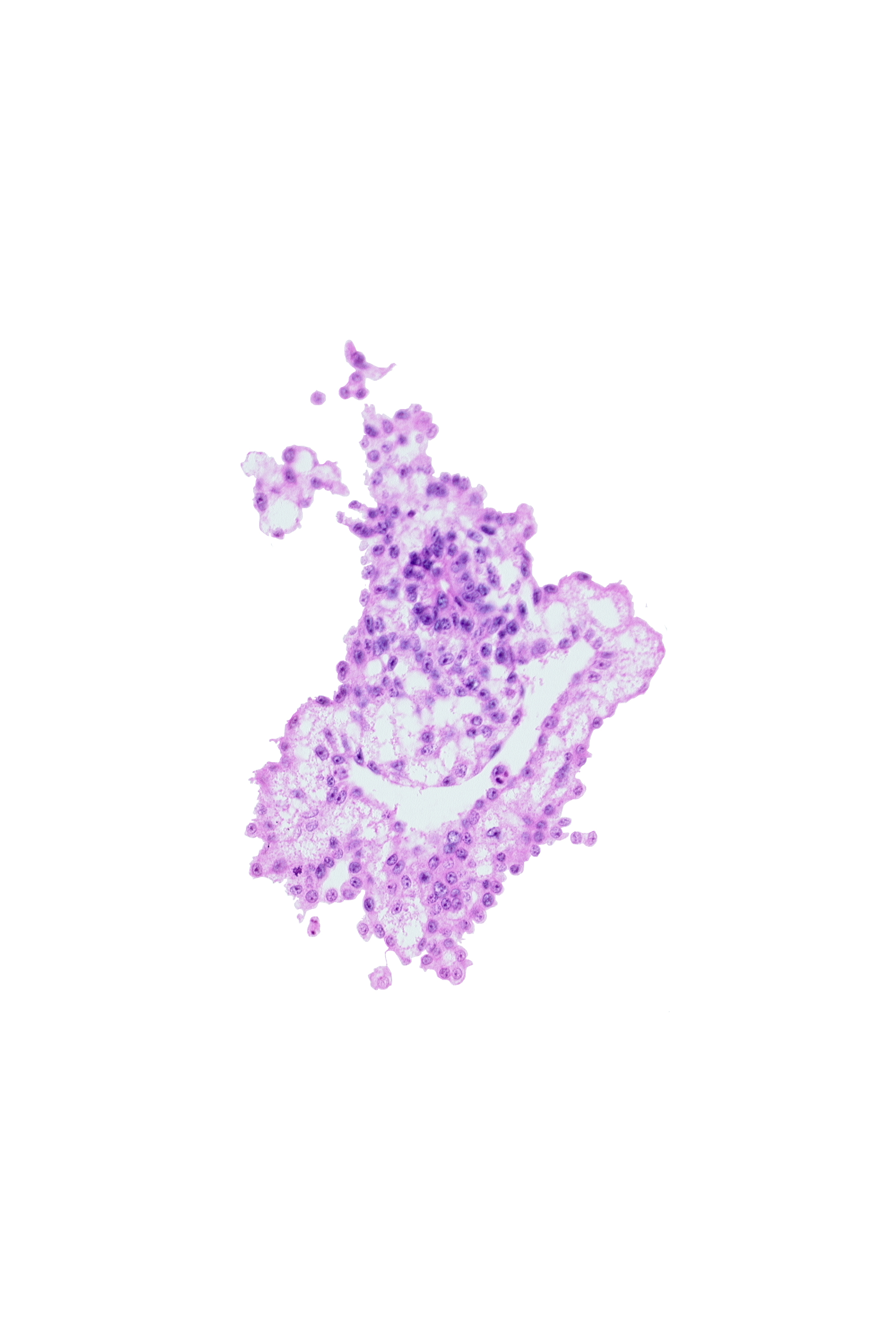 allantoic diverticulum (duct), caudal edge of connecting stalk, umbilical vesicle cavity
