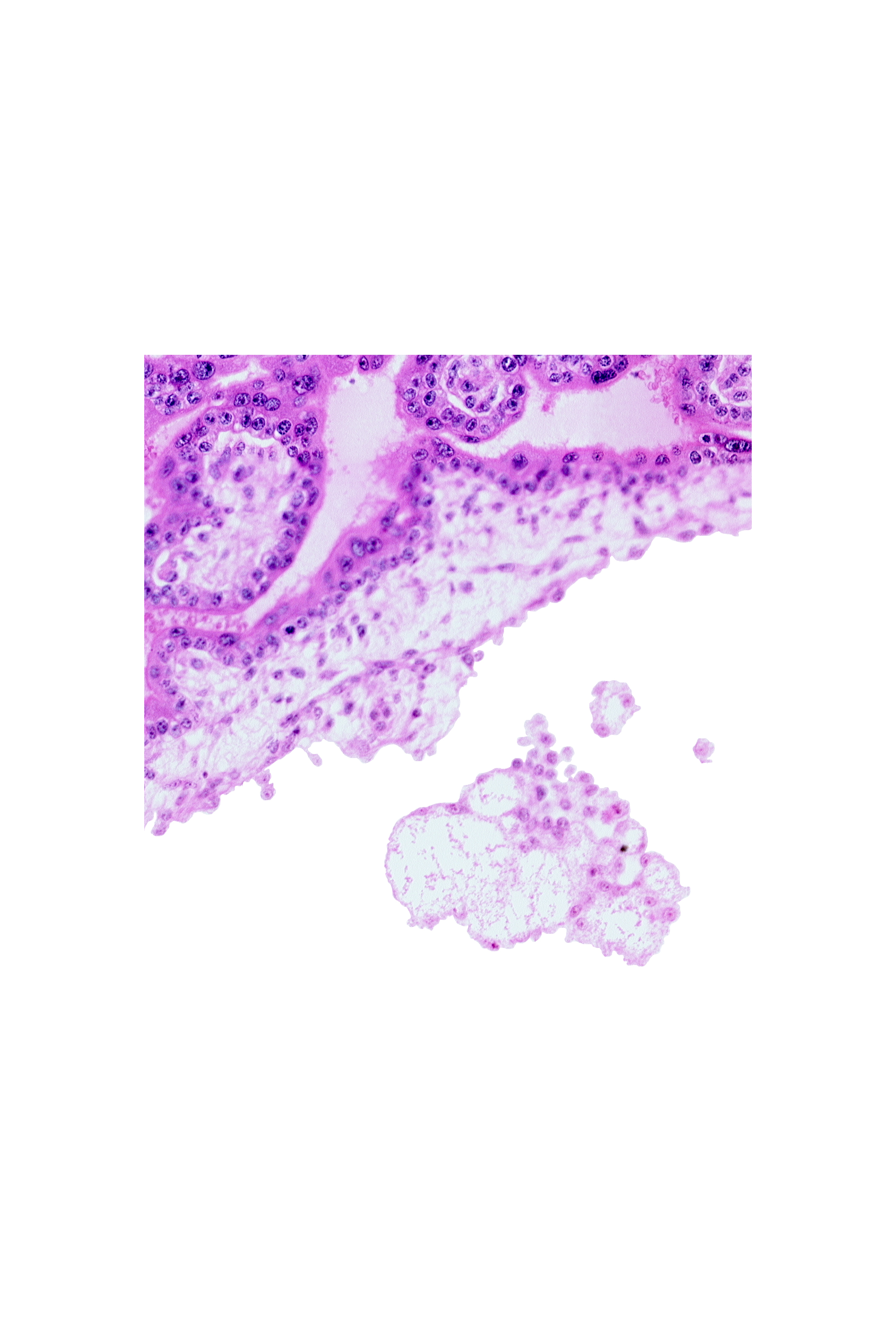 chorionic plate, extra-embryonic mesoblast, intervillus space(s)