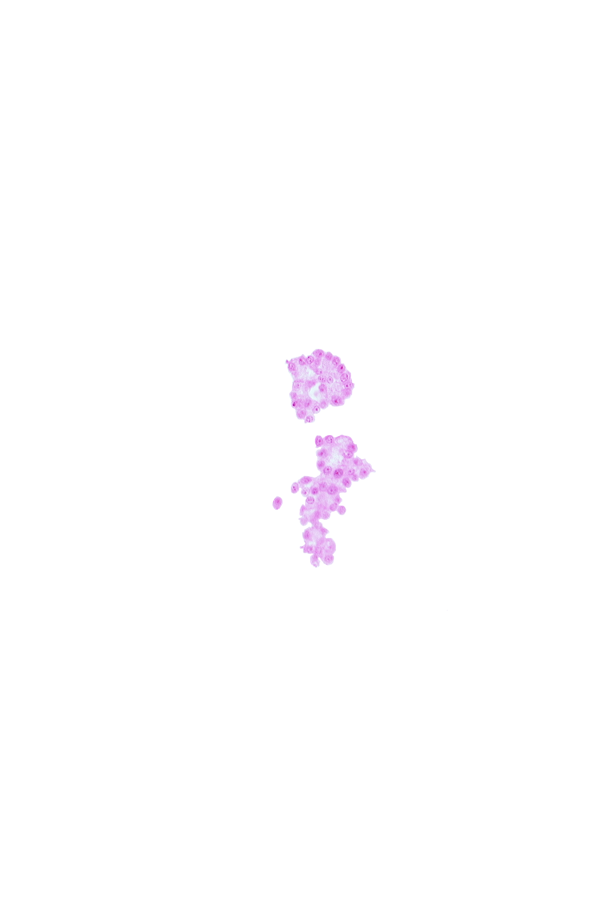 caudal part of umbilical vesicle wall