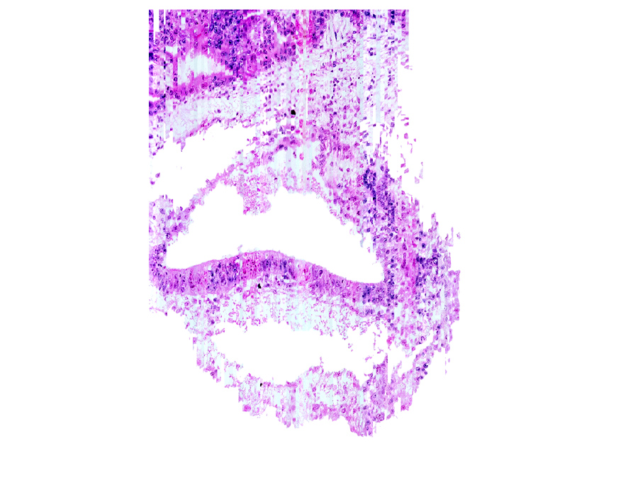 Median sagittal plane - Sections