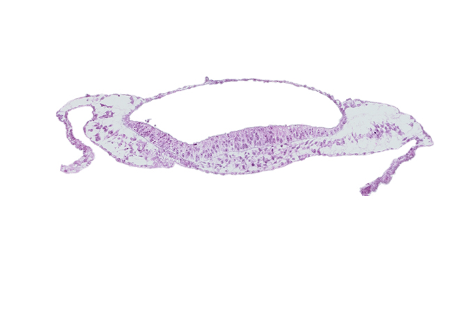 neural groove, neural plate, prechordal plate