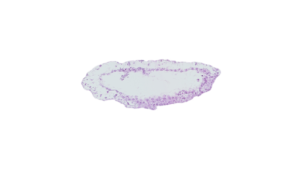 umbilical vesicle cavity