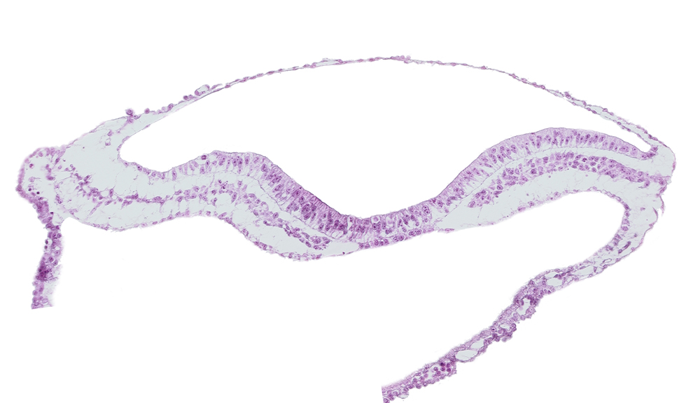 amnion, extra-embryonic endoderm, extra-embryonic mesoderm, head mesenchyme, neural fold, neural groove, notochordal plate, umbilical vesicle cavity, ventral groove (artifact?)