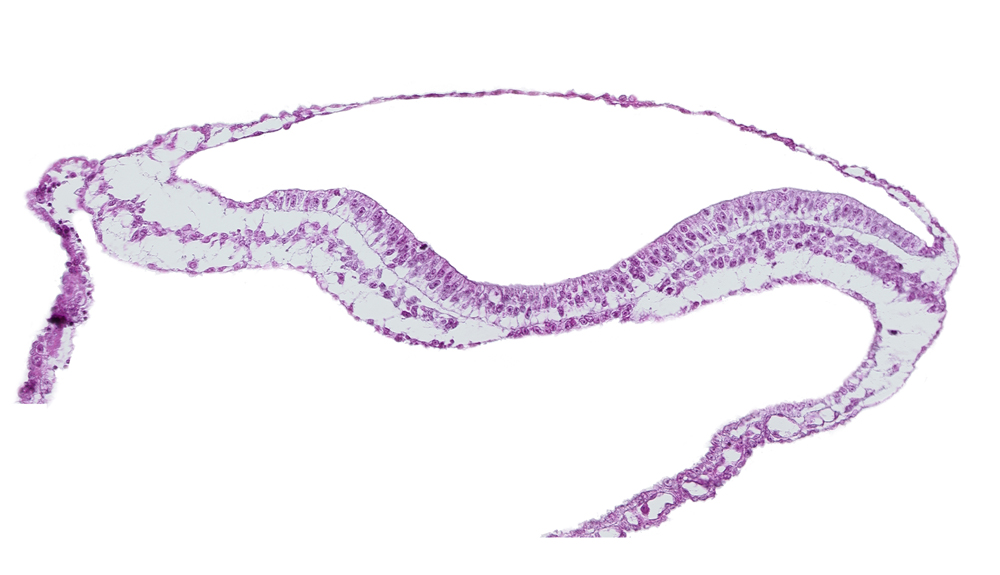 amnion, amniotic cavity, head mesenchyme, neural fold, neural groove, notochordal plate, ventral groove (artifact?)
