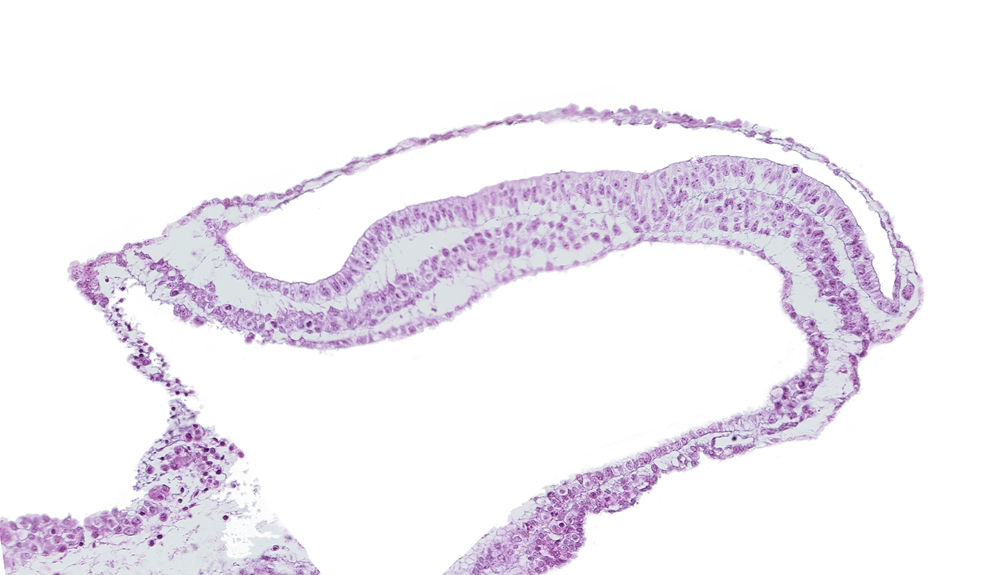 amniotic cavity, endoderm, epiblast, gastrulation (primitive) groove, gastrulation (primitive) streak, mesoderm, transverse groove, umbilical vesicle cavity
