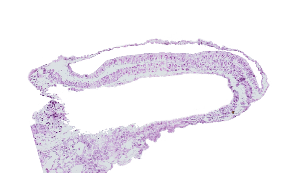 amniotic cavity, transverse groove, umbilical vesicle cavity