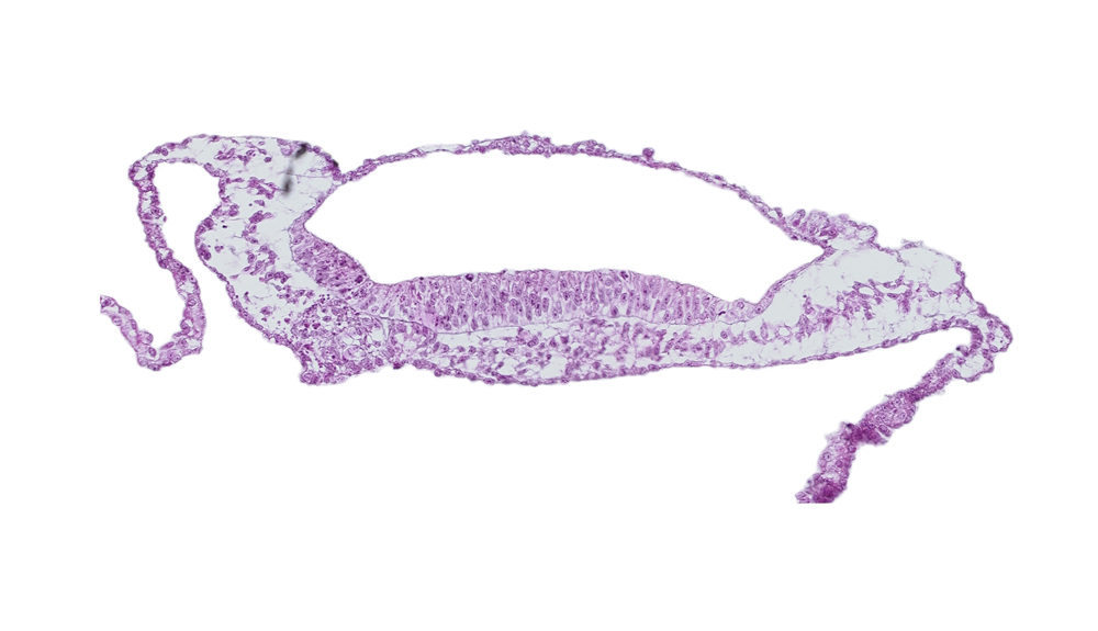 embryonic endoderm, head mesenchyme, isolated coelomic space, neural groove, neural plate, prechordal plate