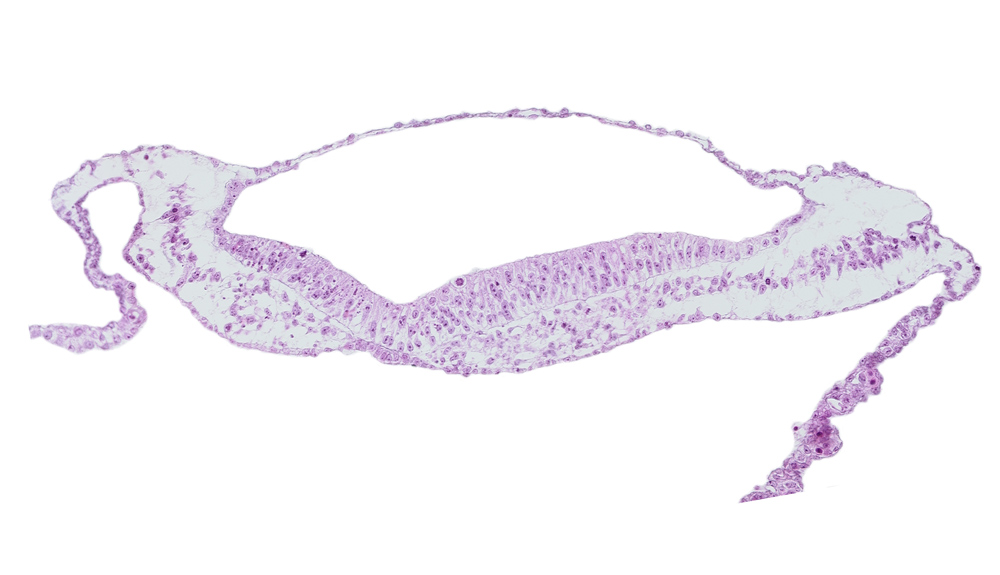 amnion, amniotic cavity, notochordal plate