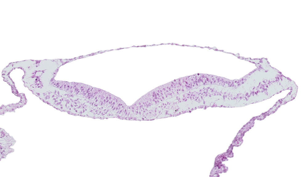 amnion, isolated coelomic space, umbilical vesicle cavity