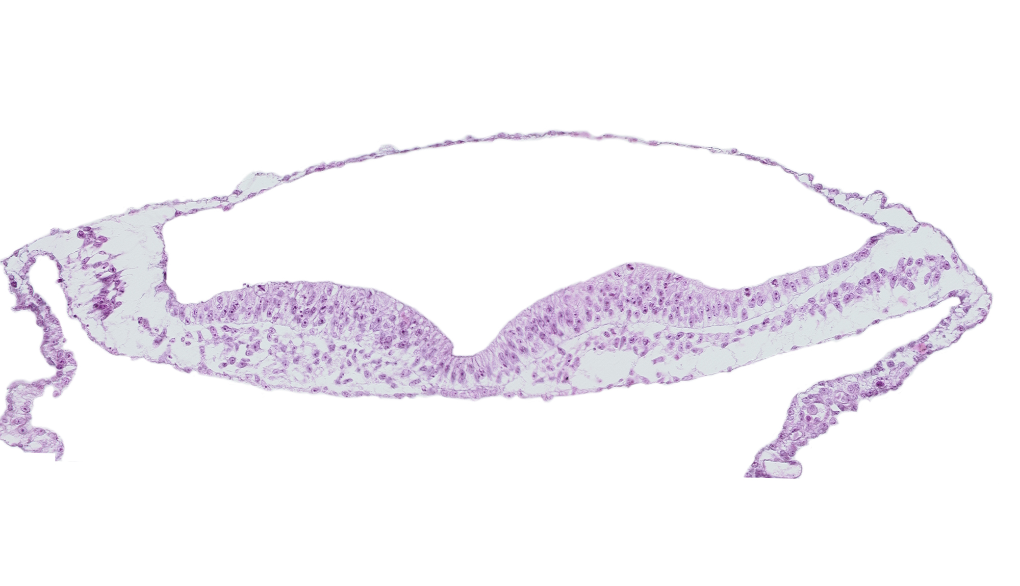 amnion, amniotic cavity, notochordal plate, presumptive neural crest