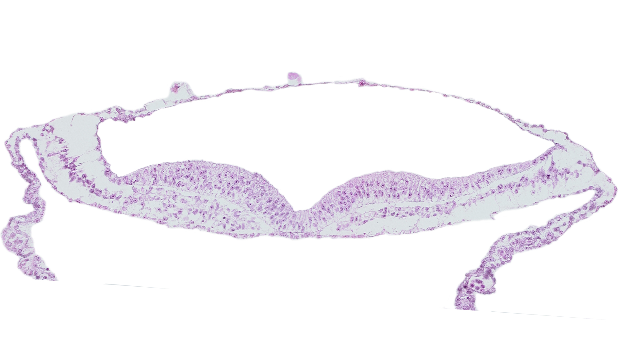 head mesenchyme, neural ectoderm, presumptive neural crest, umbilical vesicle wall