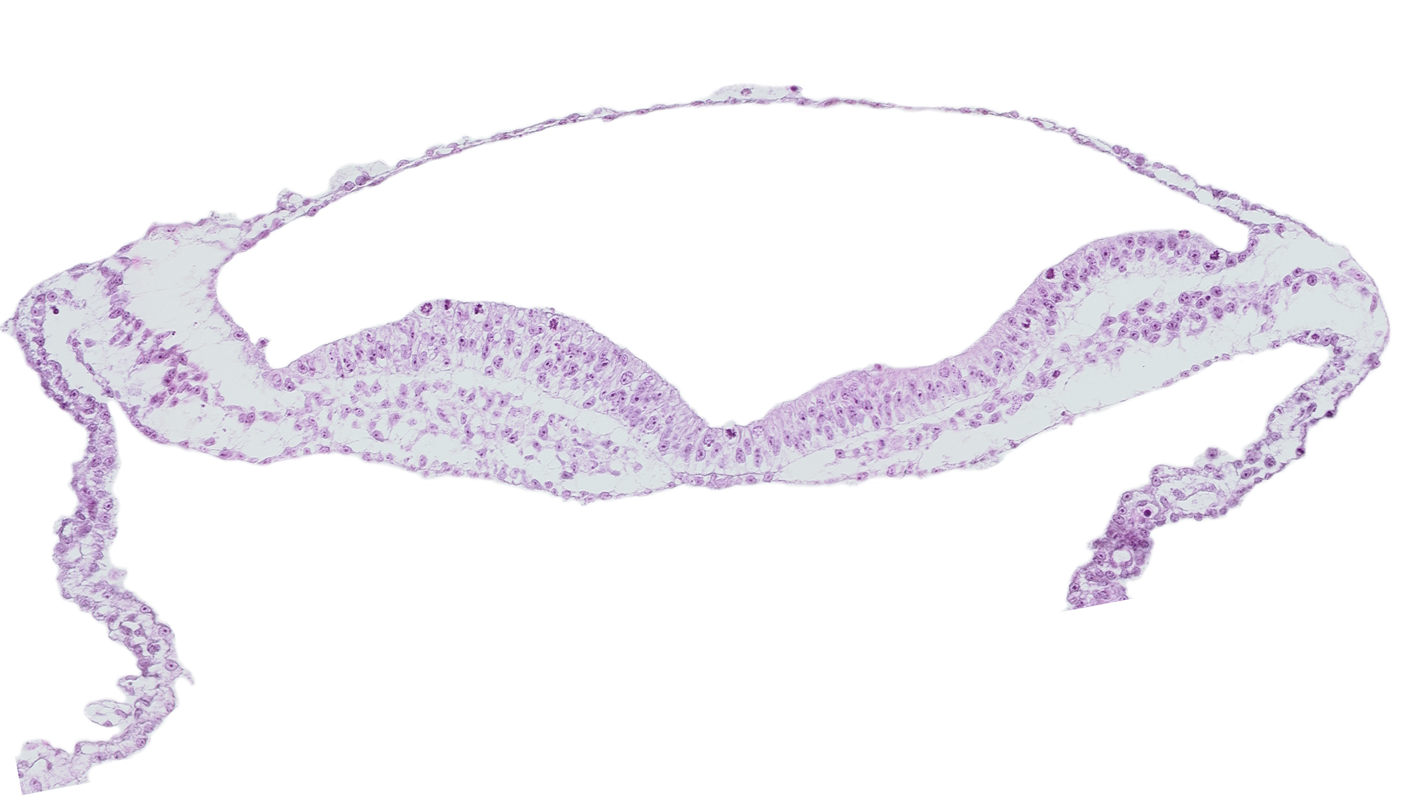 amniotic cavity, endoderm, transverse groove, umbilical vesicle wall
