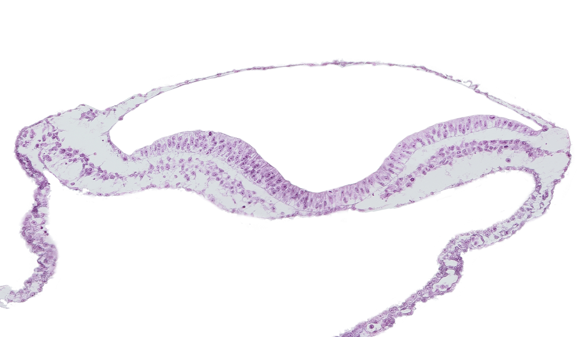 amnion, extra-embryonic endoderm, extra-embryonic mesoderm, head mesenchyme, neural fold, neural groove, notochordal plate, umbilical vesicle cavity