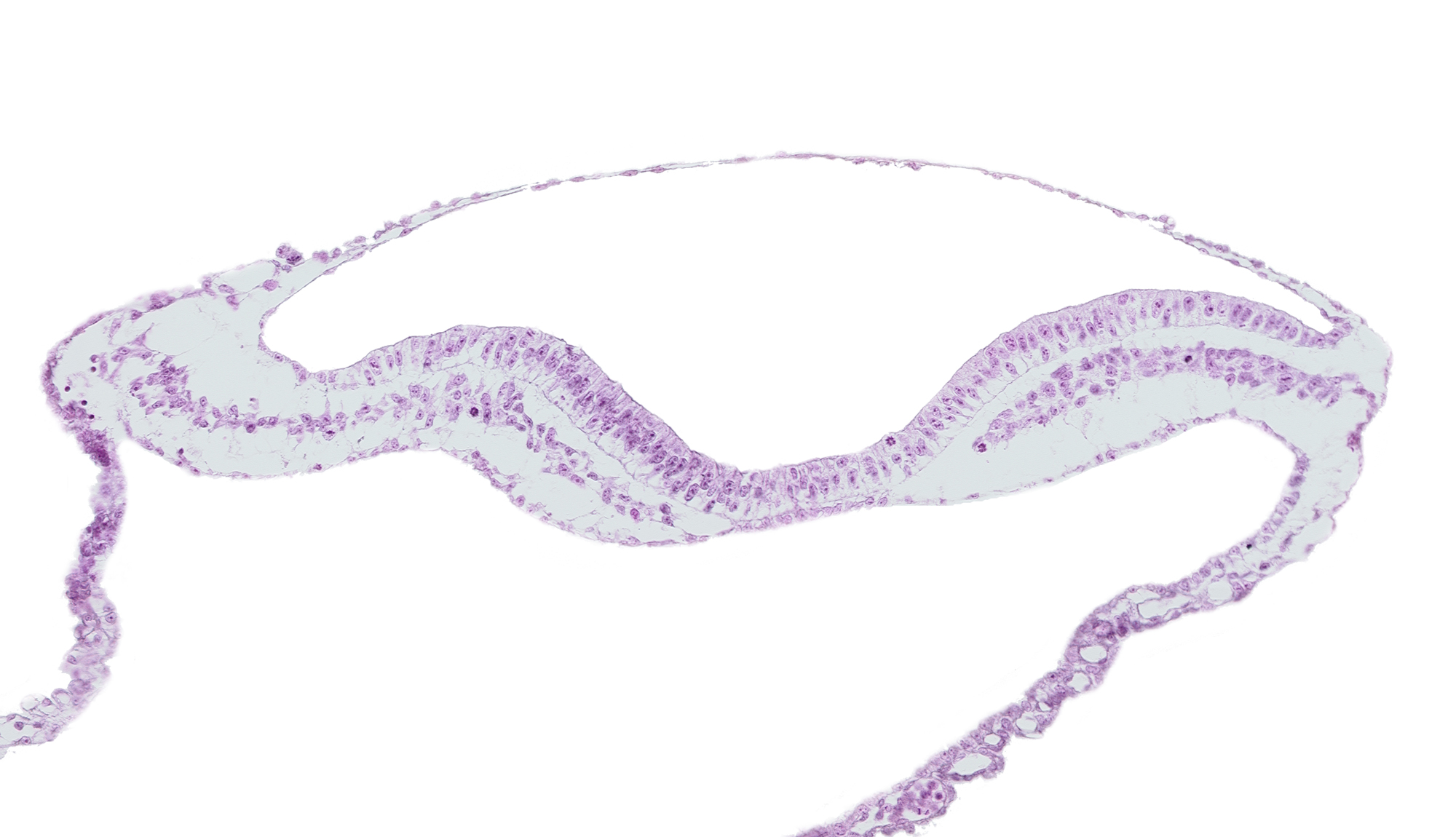 amniotic cavity, endoderm, umbilical vesicle cavity