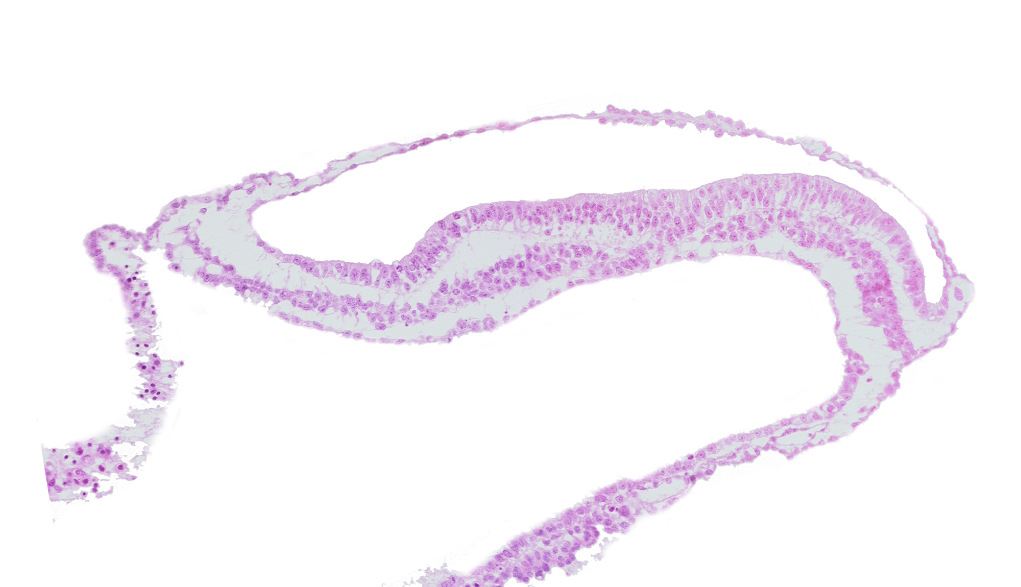 gastrulation (primitive) groove, gastrulation (primitive) streak, lateral plate mesoderm, paraxial mesoderm, transverse groove