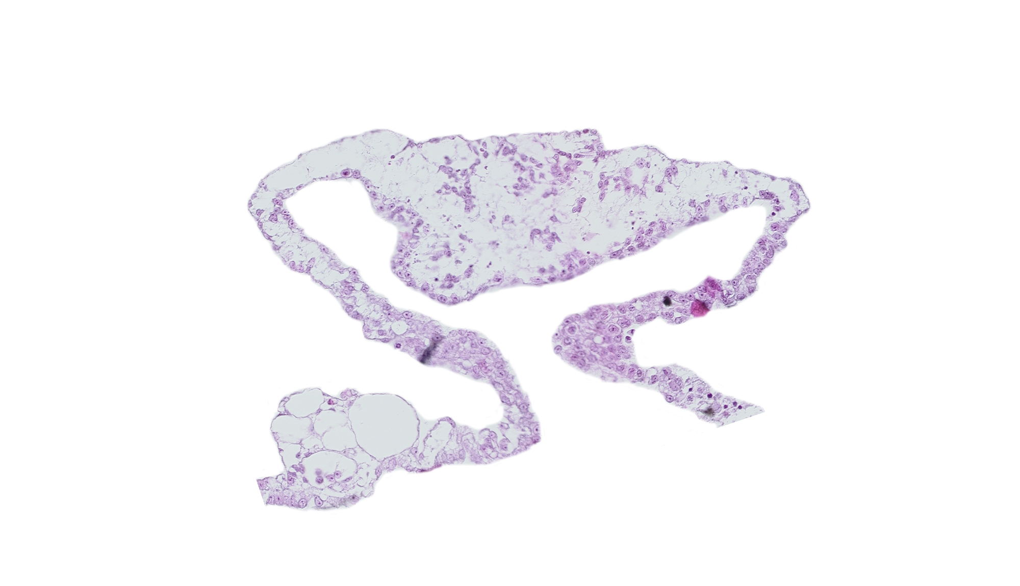 cardiac mesoderm, umbilical vesicle cavity
