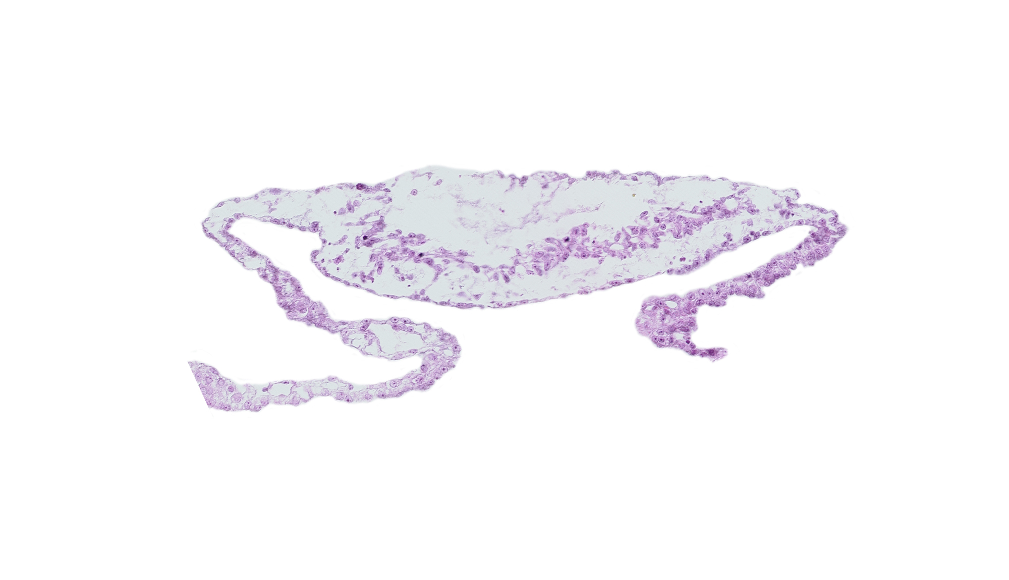 cardiac mesoderm