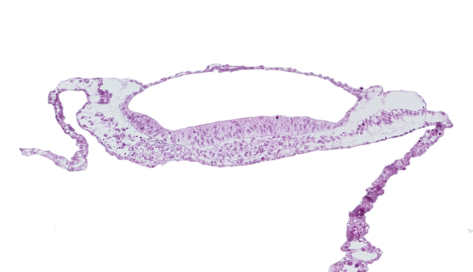 neural groove, neural plate, prechordal plate