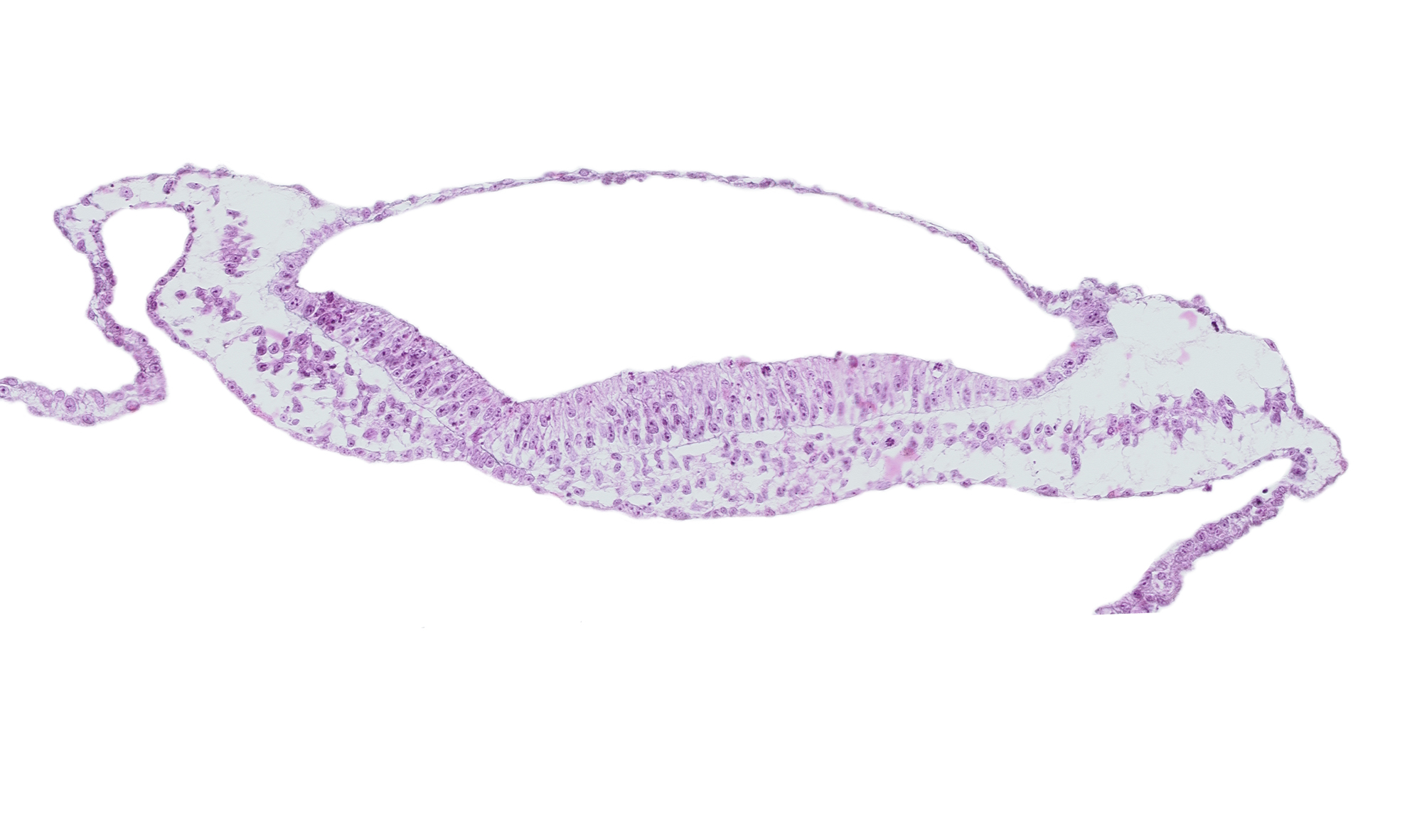 neural groove, notochordal plate