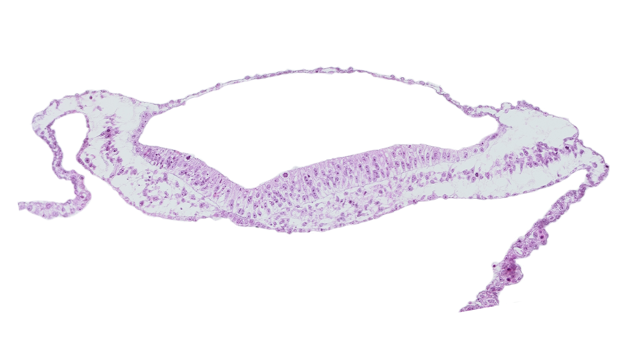 amnion, amniotic cavity, notochordal plate