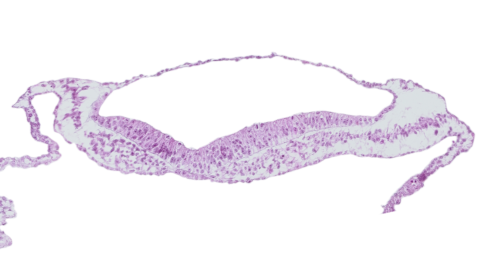 amniotic cavity, head mesenchyme, isolated coelomic space, notochordal plate, umbilical vesicle cavity